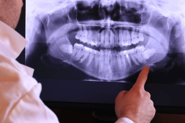Emergency Gum Pain Relief in OH