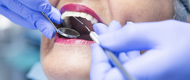 Best Broken Tooth Emergency  in Massillon, OH